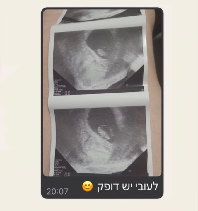 הודעה ממטופלת